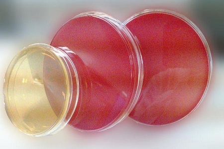 Salmonella Shigella Agar (SS) - ရောဂါဖြစ်ပွားမှုအထီးကျန်မှုအတွက်မရှိမဖြစ်လိုအပ်သောအလယ်အလတ်