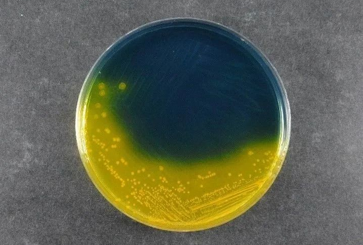 Babio ၏ Salmonella Shigella Agar (SS) သည် Babio ၏ Salmonella Shigella Agar (SS) သည်ကမ္ဘာလုံးဆိုင်ရာရောဂါပိုးရှာဖွေတွေ့ရှိမှုစံနှုန်းများကိုထောက်ပံ့သည်