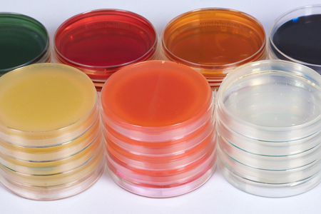 Triple သကြား Iron agar (TSI) - Centeric Bacilli ၏တိကျသောကွဲပြားခြားနားမှု
