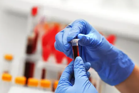 BABIO သည် Fluorescence Bovine Pregnancy Rapid Test ကို စတင်သည်။