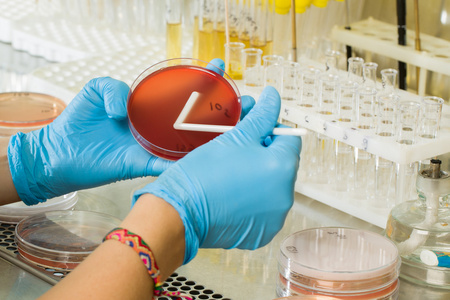 BABIO ၏ MacConkey Agar Medium - ကမ္ဘာလုံးဆိုင်ရာ အဏုဇီဝရောဂါရှာဖွေရေးများအတွက် ပရီမီယံရွေးချယ်ထားသော သီးခြားခွဲထုတ်ခြင်း